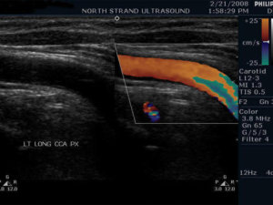 Ultra Sound Baby Womb North Strand Ultra Sound Myrtle Beach