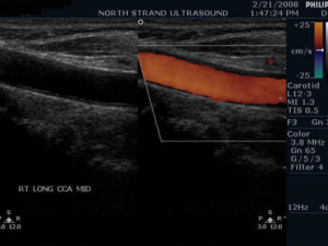 Ultra Sound Baby Womb North Strand Ultra Sound Myrtle Beach