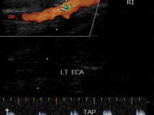 Ultra Sound Baby Womb North Strand Ultra Sound Myrtle Beach