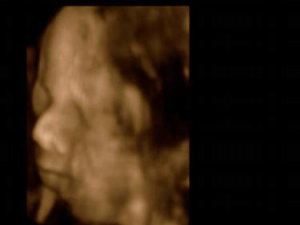 Ultra Sound Baby Womb North Strand Ultra Sound Myrtle Beach