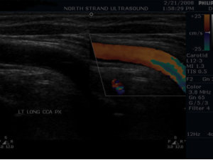 Ultra Sound Baby Womb North Strand Ultra Sound Myrtle Beach