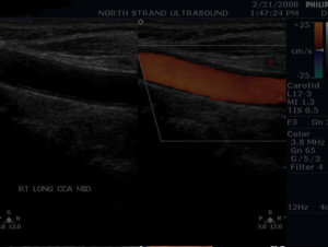 Ultra Sound Baby Womb North Strand Ultra Sound Myrtle Beach