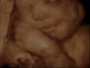 Ultra Sound Baby Womb North Strand Ultra Sound Myrtle Beach