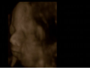 Ultra Sound Baby Womb North Strand Ultra Sound Myrtle Beach