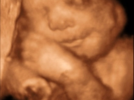 Ultra Sound Baby Womb North Strand Ultra Sound Myrtle Beach