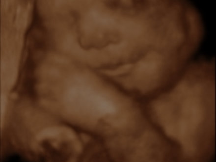 Ultra Sound Baby Womb North Strand Ultra Sound Myrtle Beach